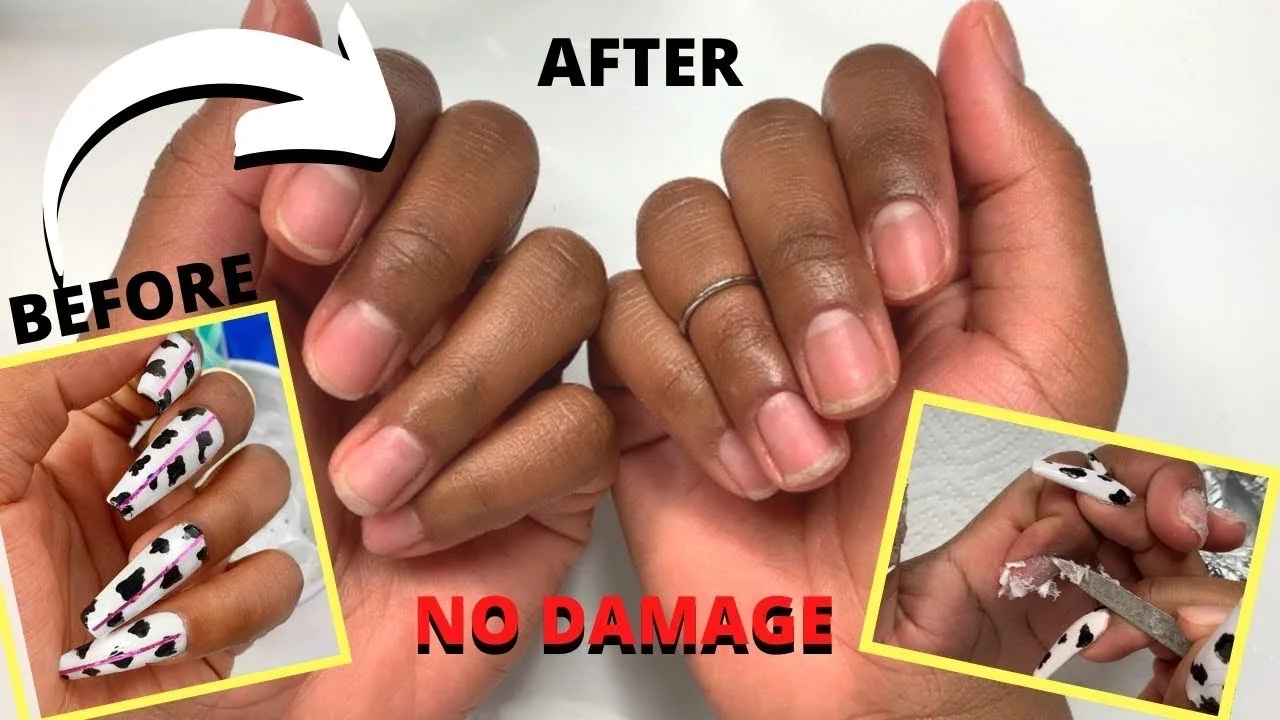 How can you safely remove Gel-X nails without damage How can you safely remove Gel-X nails without damage