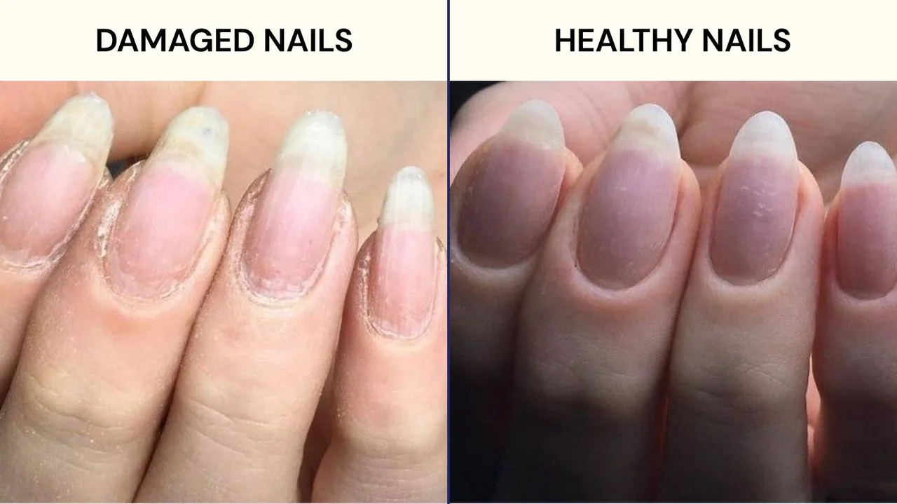 What Are the Aftercare Steps for Nails Post Gel Removal What Are the Aftercare Steps for Nails Post Gel Removal