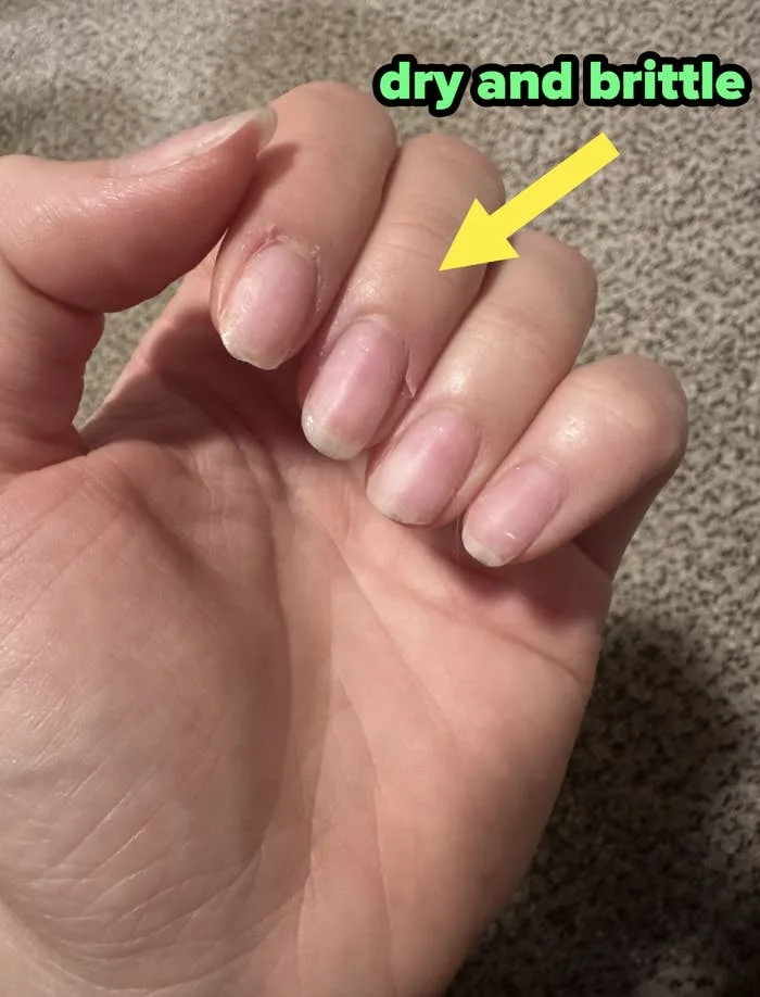 What are the drawbacks of hard gel nails What are the drawbacks of hard gel nails
